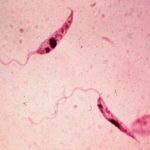 1 leishmaniose cutanea