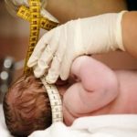 zika-microcefalia-ufma